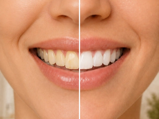 How to Actually Whiten Teeth Safely at Home